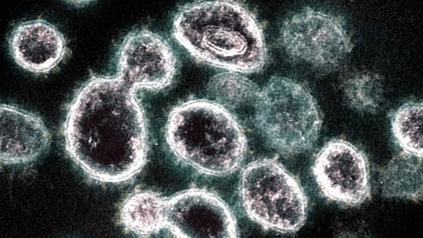 coronavirus Photo: Bloomberg
