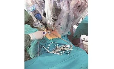 robotic surgery robotic surgery