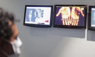 Monkeypox patients could be infectious for up to 4 weeks: Experts Monkeypox