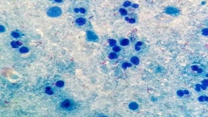 Marburg virus Marburg virus