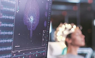 neuro, medical, brain, pharma neuro, medical, brain, pharma