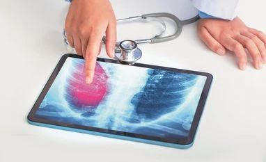 'Govt implementing largest digital programme for TB surveillance' pneumoniae, health cases,