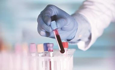 ICMR to conduct first Chintan Shivir for sickle cell disease research Sickle cell disease, health, drug