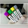 Healthcare workers at higher risk of TB than general population, says study | Health News TB