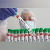 Odisha govt culls over 11,700 chicken, health dept issues alert on bird flu | India News bird flu in west bengal