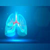 Lung Cancer Lung Cancer