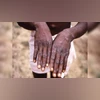 Why did WHO declare Mpox as health emergency of international concern? | Health News - Business Standard