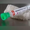 Monkeypox Monkeypox