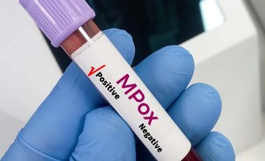 Learning from Covid pandemic experience to contain the Mpox outbreak Monkeypox