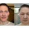 Tech millionaire's 'baby face' experiment goes wrong, face 'blows up'