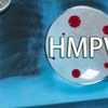 HMPV, disease, illness, health