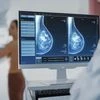 breast cancer, cancer screening
