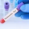 Could gene therapy end thalassemia? China's breakthrough sparks hope