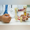 Appendix cancer rising among millennials: Causes, signs, and what to do