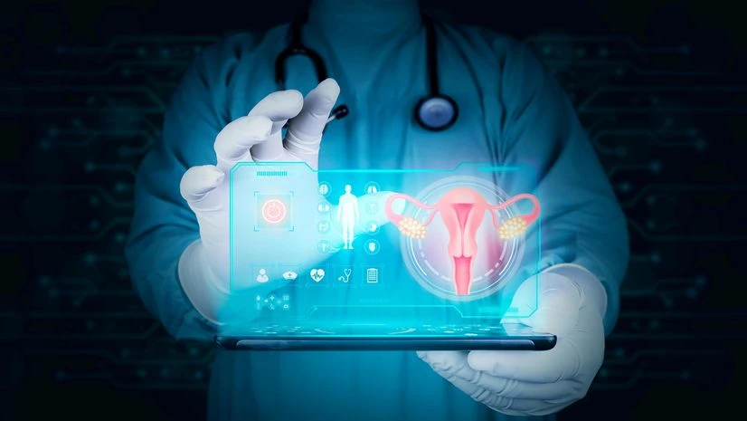 endometriosis endometriosis