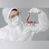 blood tet, report, health