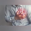 heart attack, heart attack early signs heart attack