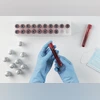 Blood tests