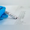 Hepatitis D