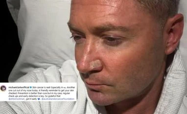 Former Australia captain Michael Clarke undergoes skin cancer surgery Former Australia captain Michael Clarke