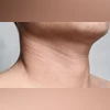 neck size neck circumference, neck size can signal health issues
