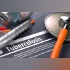 Tuberculosis Tuberculosis
