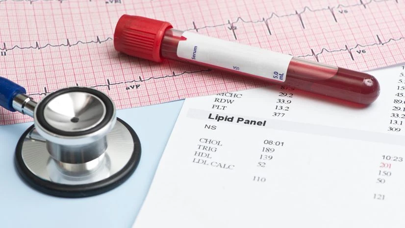 lipid test, cholesterol check, heart health lipid test, cholesterol check, heart health