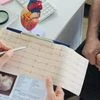 The silent threat of irregular heartbeats: Doctors explain arrhythmia
