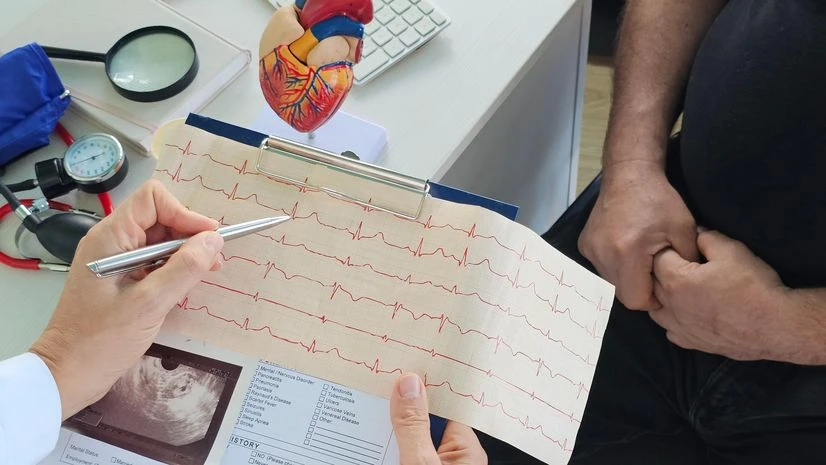 arrhythmia, irregular heartbeat, heart health arrhythmia, irregular heartbeat, heart health