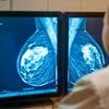 Meet BCECNN: The AI that detects breast cancer and explains its logic