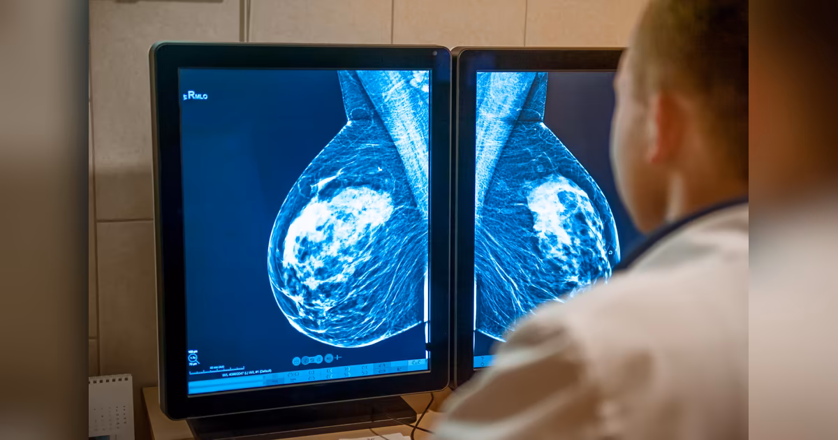 Immune cells 'betray' body to aid breast cancer spread, finds new study