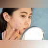 Acne: A GP's guide to understanding, managing, and preventing it Acne, acne face
