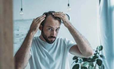 Hair today, not gone tomorrow: New serum may make baldness reversible baldness cure, hair regrowth