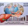 Apollo Hospitals Achieves Historic Milestone: Completes 5,000 Liver Transplants, Sets a New Benchmark for Indian and South Asian Healthcare