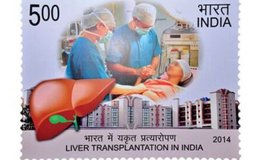 Apollo Hospitals Achieves Historic Milestone: Completes 5,000 Liver Transplants, Sets a New Benchmark for Indian and South Asian Healthcare Apollo Hospitals Achieves Historic Milestone: Completes 5,000 Liver Transplants, Sets a New Benchmark for Indian and South Asian Healthcare