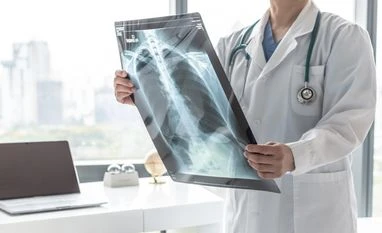 TB still kills 1.23 million a year as WHO warns progress may slip away tuberculosis