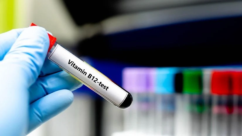 vitamin B12 vitamin B12